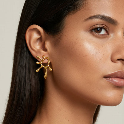 Aretes Magma